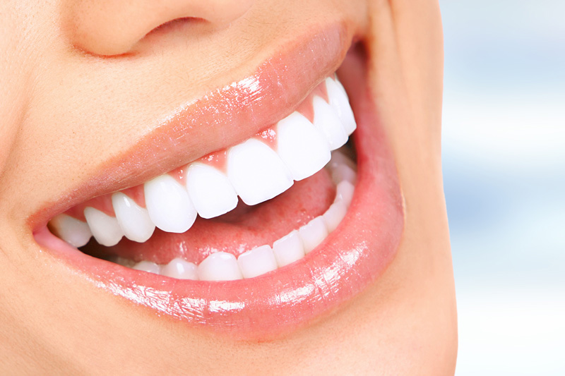 Quality Dental Treatments in Houston